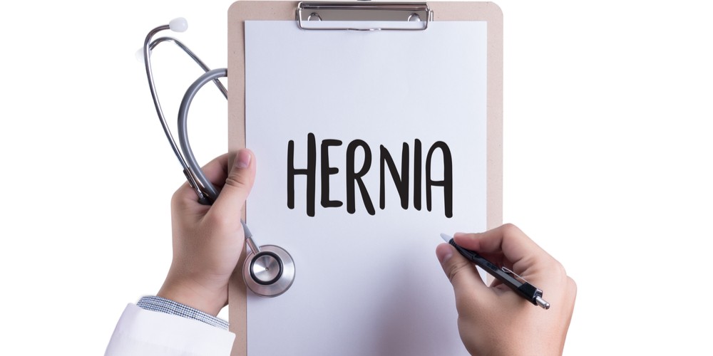 List Of Instructions To Follow After Hernia Surgery