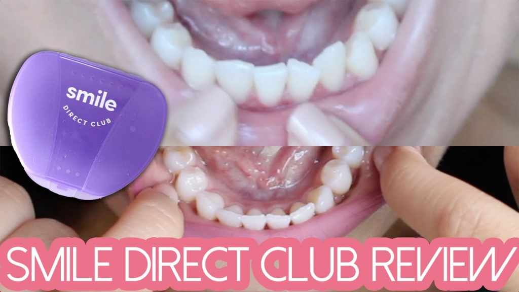 smile direct club reviews