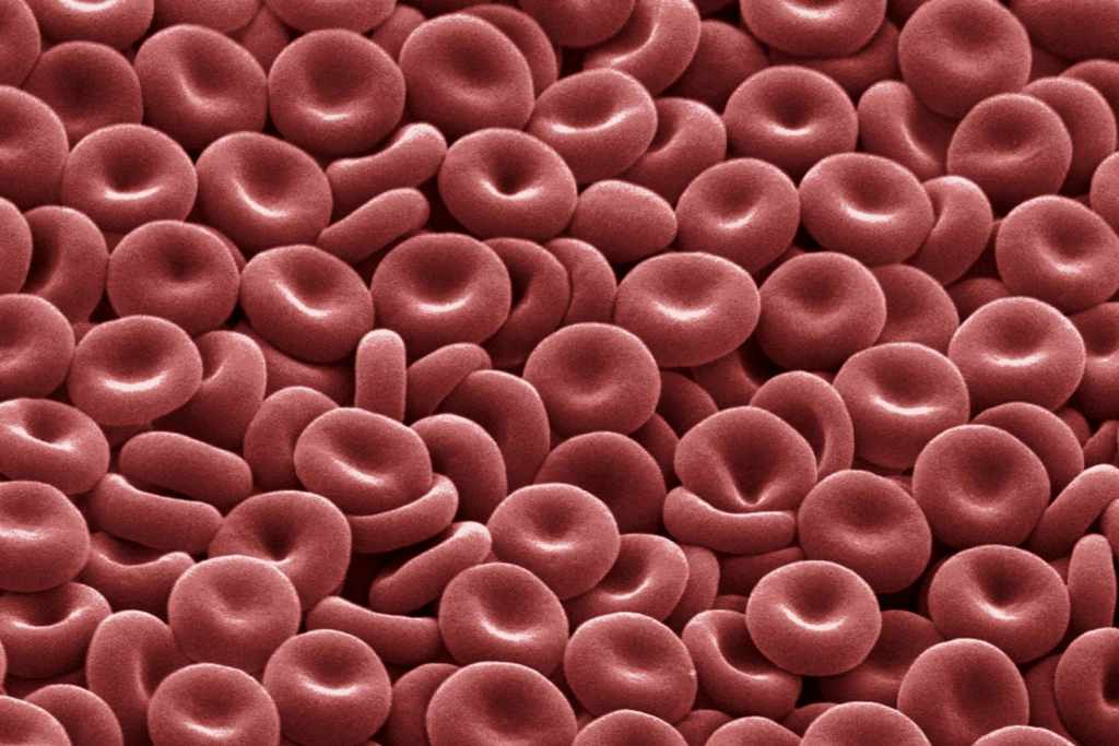 high red blood cell count